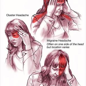 Headache Log - Common Migraine Symptoms