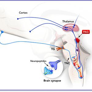 Headache After Period - Keeping A Migraine Headache Journal: What You Should Note For Your Doctor