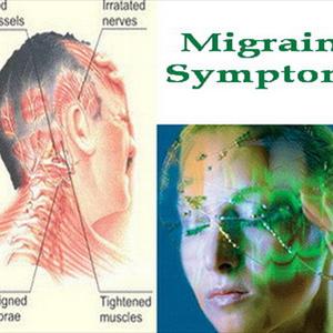 Neurontin Migraine - Migraines And Women