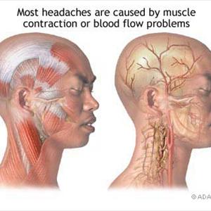 International Classification Of Headache Disorders 2 - General Factors That Could Trigger Off An Attack